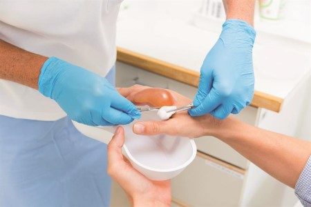 أفضل كريم لعلاج حروق الماء الساخن