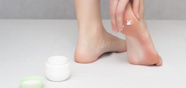 افضل كريم لتشققات القدم