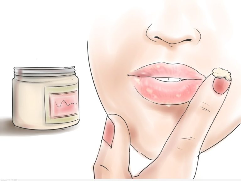 كريم تفتيح الشفايف من الصيدلية